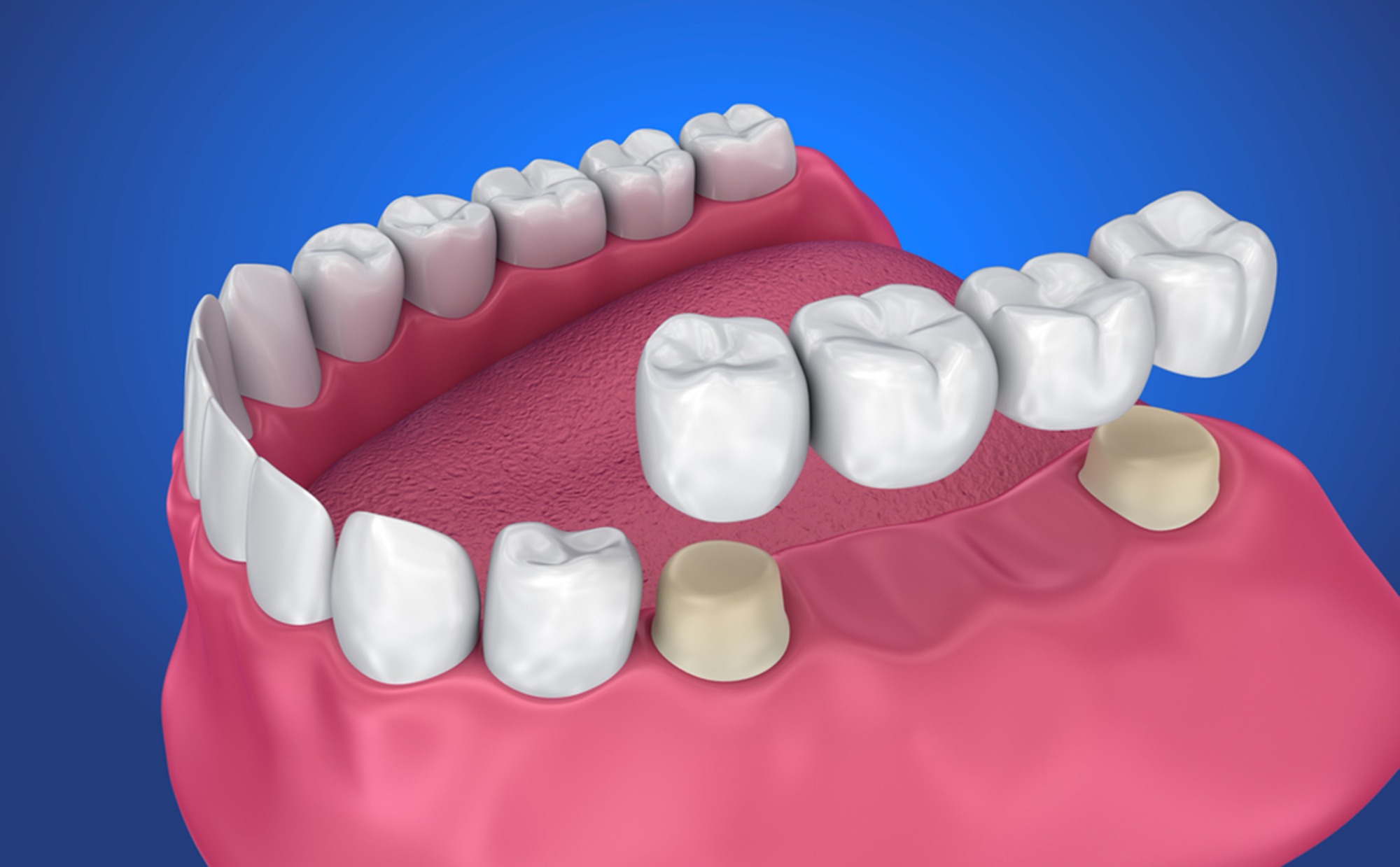 Modern orthodontic treatments at Charizma Dental Clinic