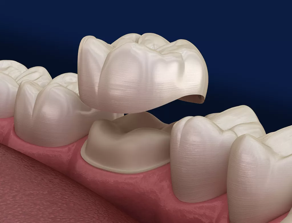 Modern orthodontic treatments at Charizma Dental Clinic