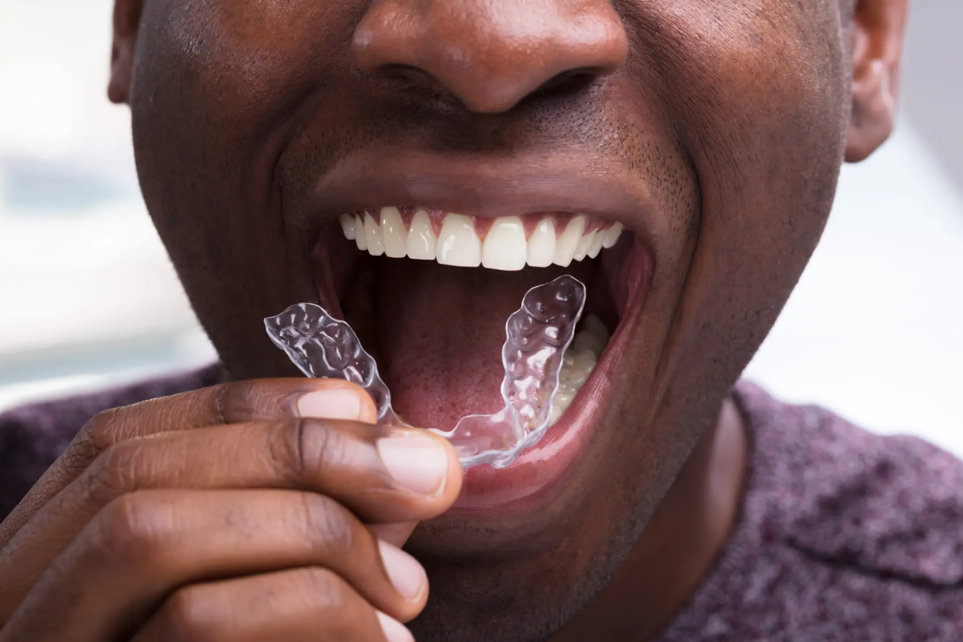 Modern orthodontic treatments at Charizma Dental Clinic